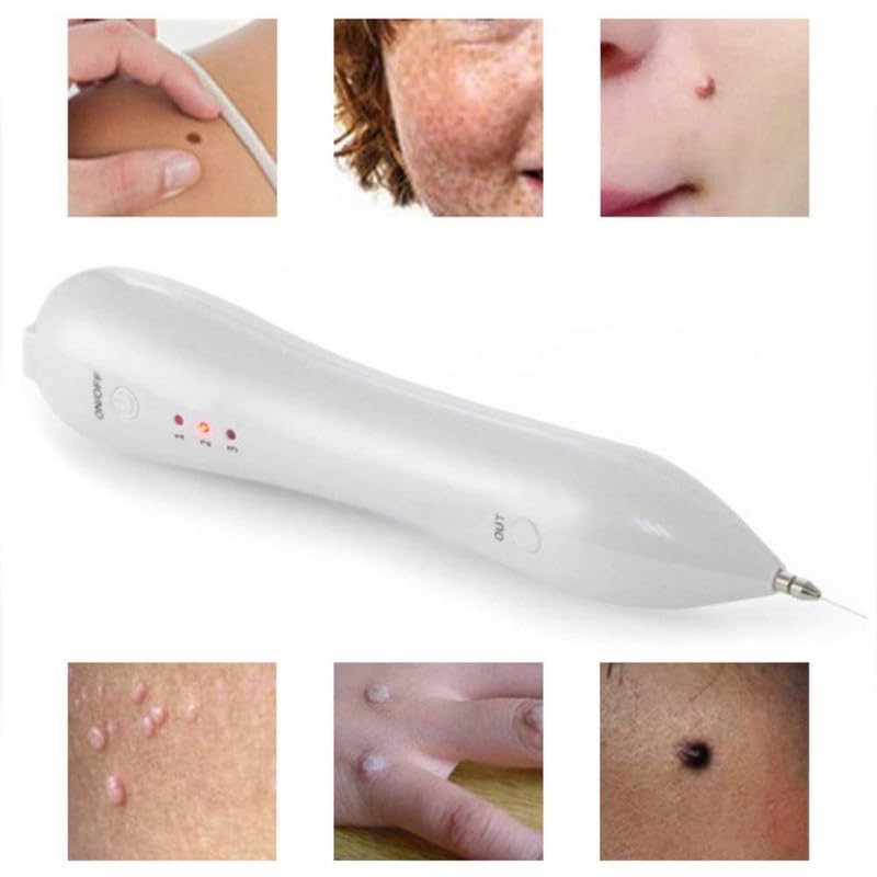 Electric Spot & Mole Removal Pen – 3-Level Plasma Laser Beauty Tool